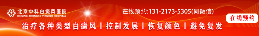 北京中科白癜風醫院